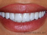 Комплексная стоматология «Stomtravel» (Стомтревел)