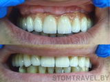 Комплексная стоматология «Stomtravel» (Стомтревел)